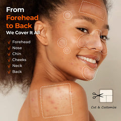 Parche TKTK de 10mm para granos, ofrece cobertura precisa