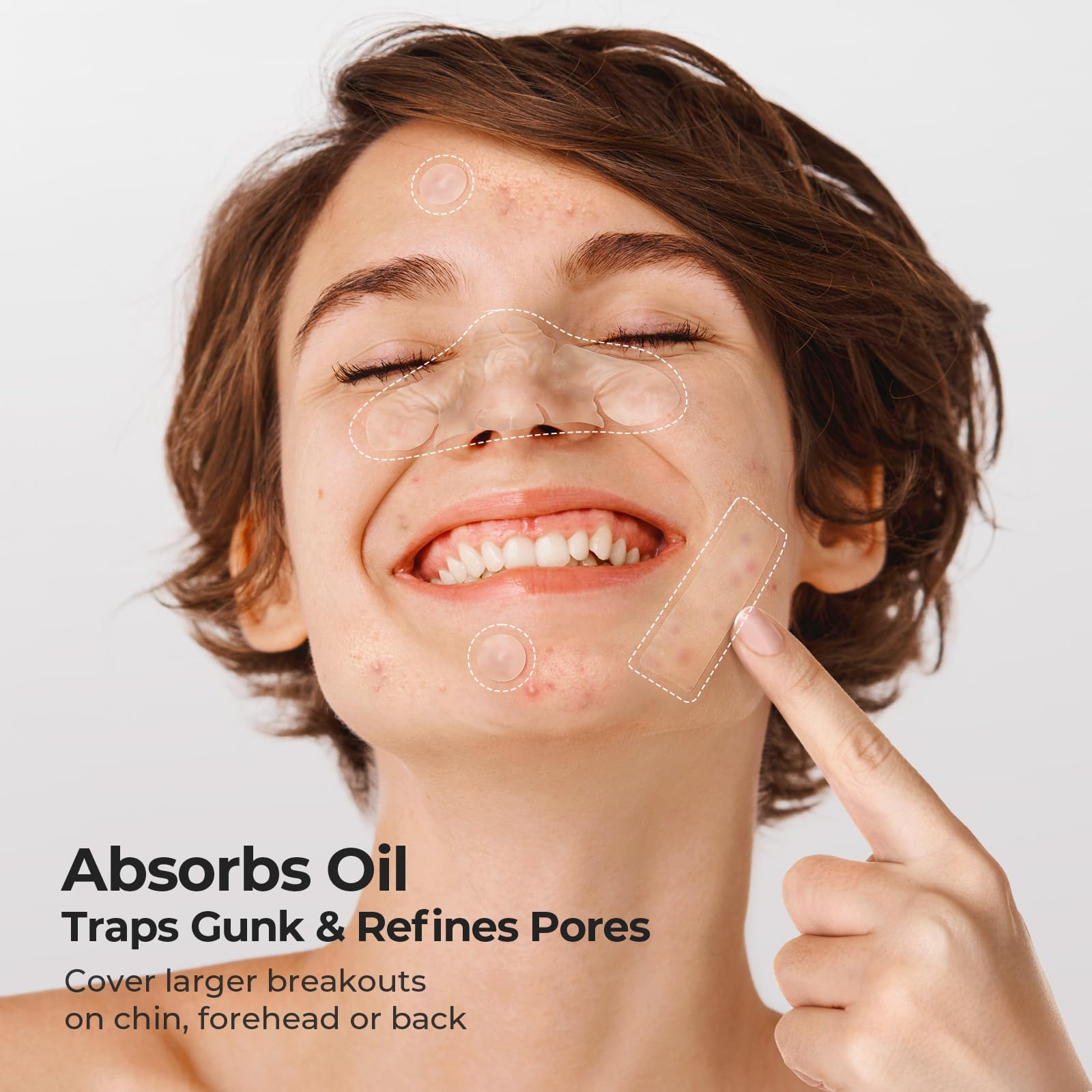 Parches acne grandes TKTK, tira 60x20 mm para zonas amplias.