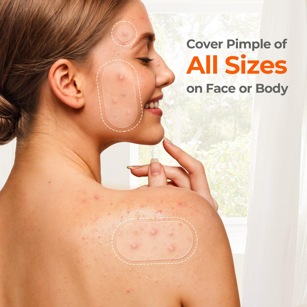 Pack de 443 parches TKTK para acné, ahorro y conveniencia.