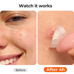 Parche TKTK para uso diario bajo maquillaje, cómodo y discreto