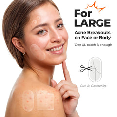 Punto de 8 mm TKTK para tratamiento focal rápido.