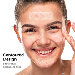 Parche tktk 8 mm para áreas pequeñas