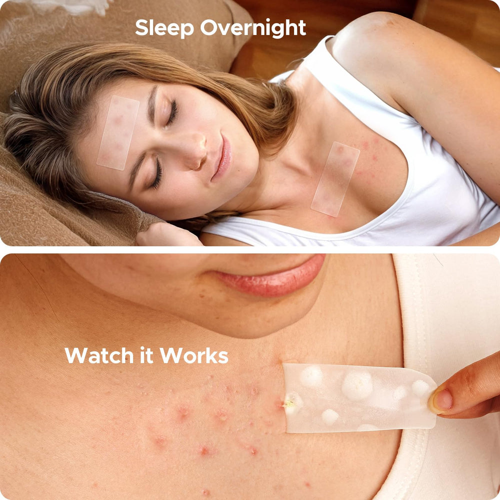 Conjunto de parch es en 5 tallas para rostro, espalda y pecho.