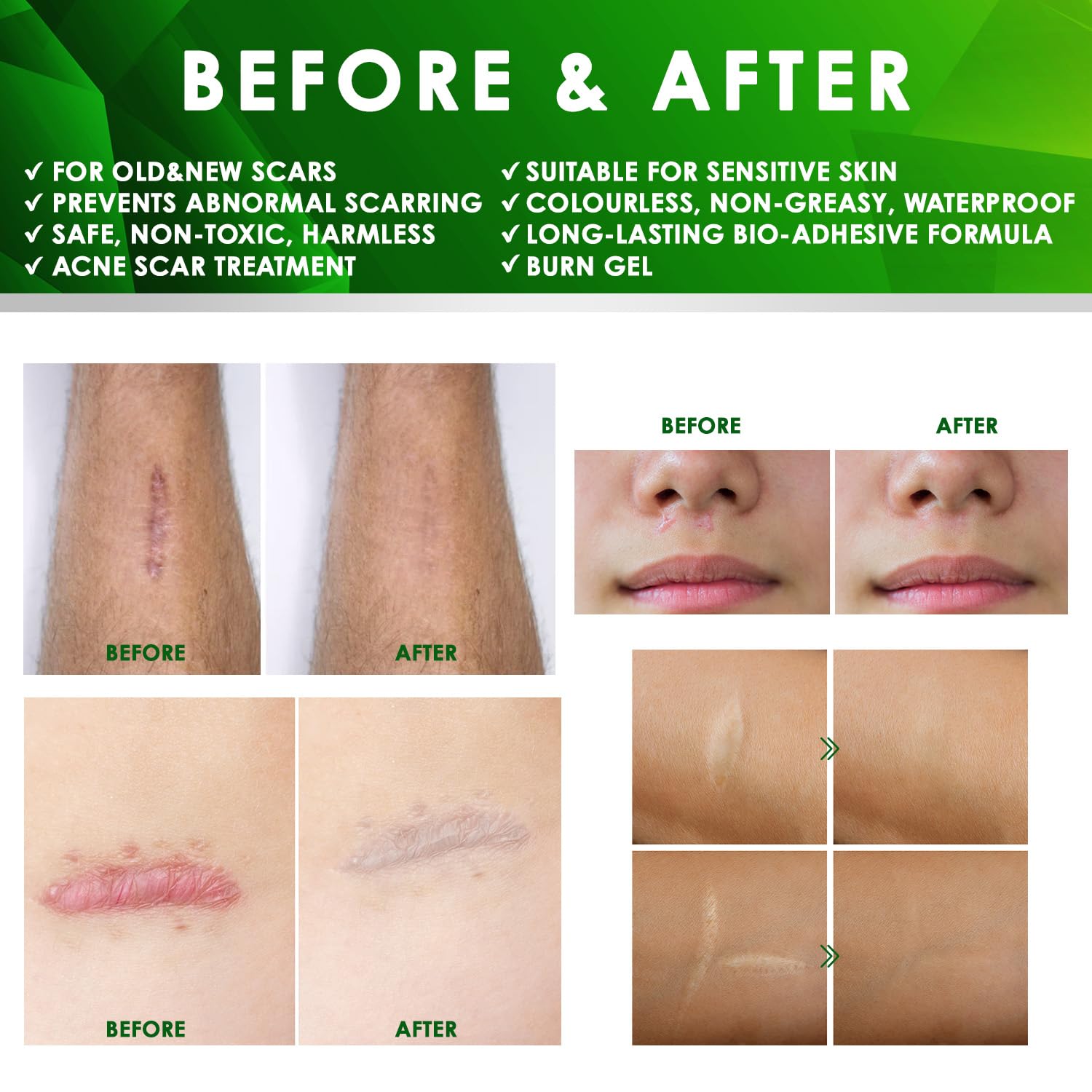 Tobcharm ear-area application demonstrates daily scar care routine