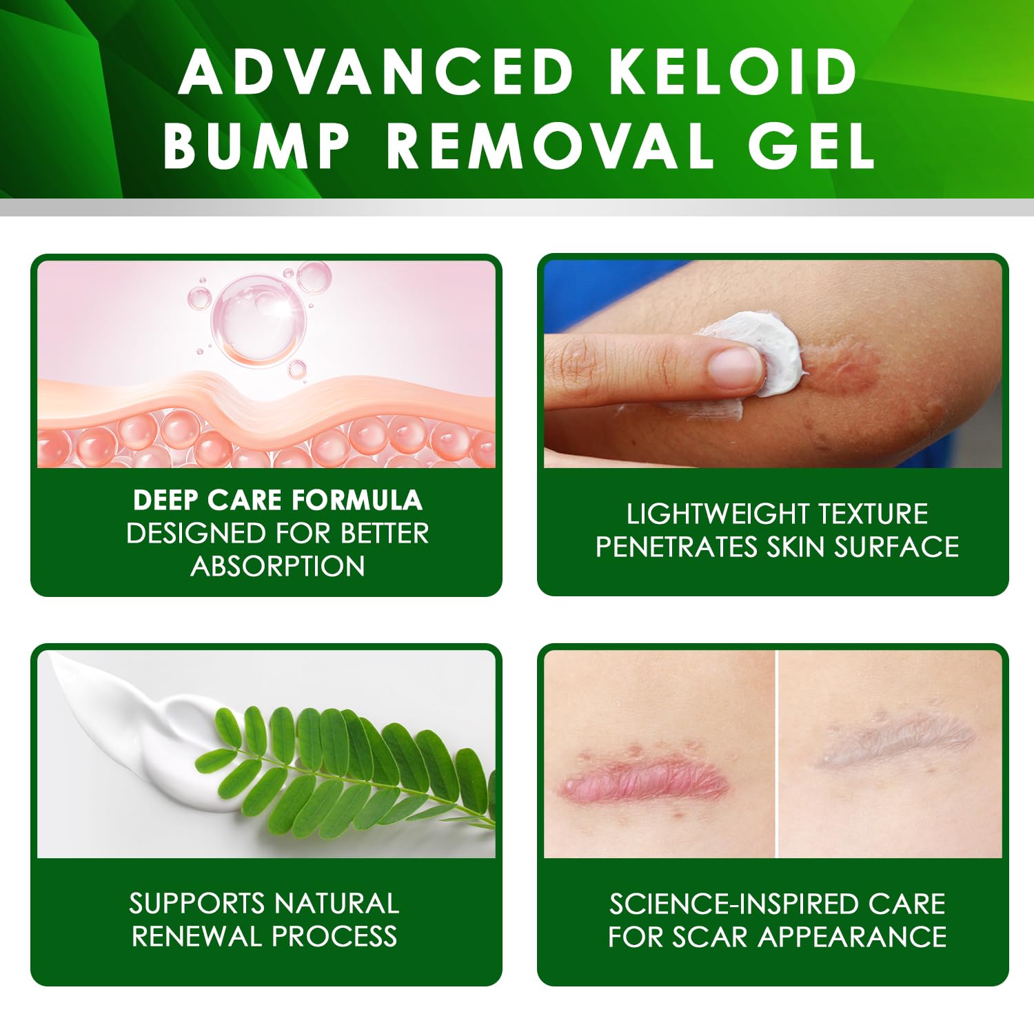 Tobcharm gel texture closeup demonstrates smooth application for scar care