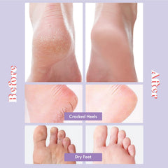 Toi:L – application du masque-pieds pendant 20 minutes sans rinçage.