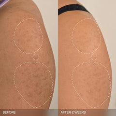Topicals Slather Exfoliating Bar hydrates while exfoliating dry patches