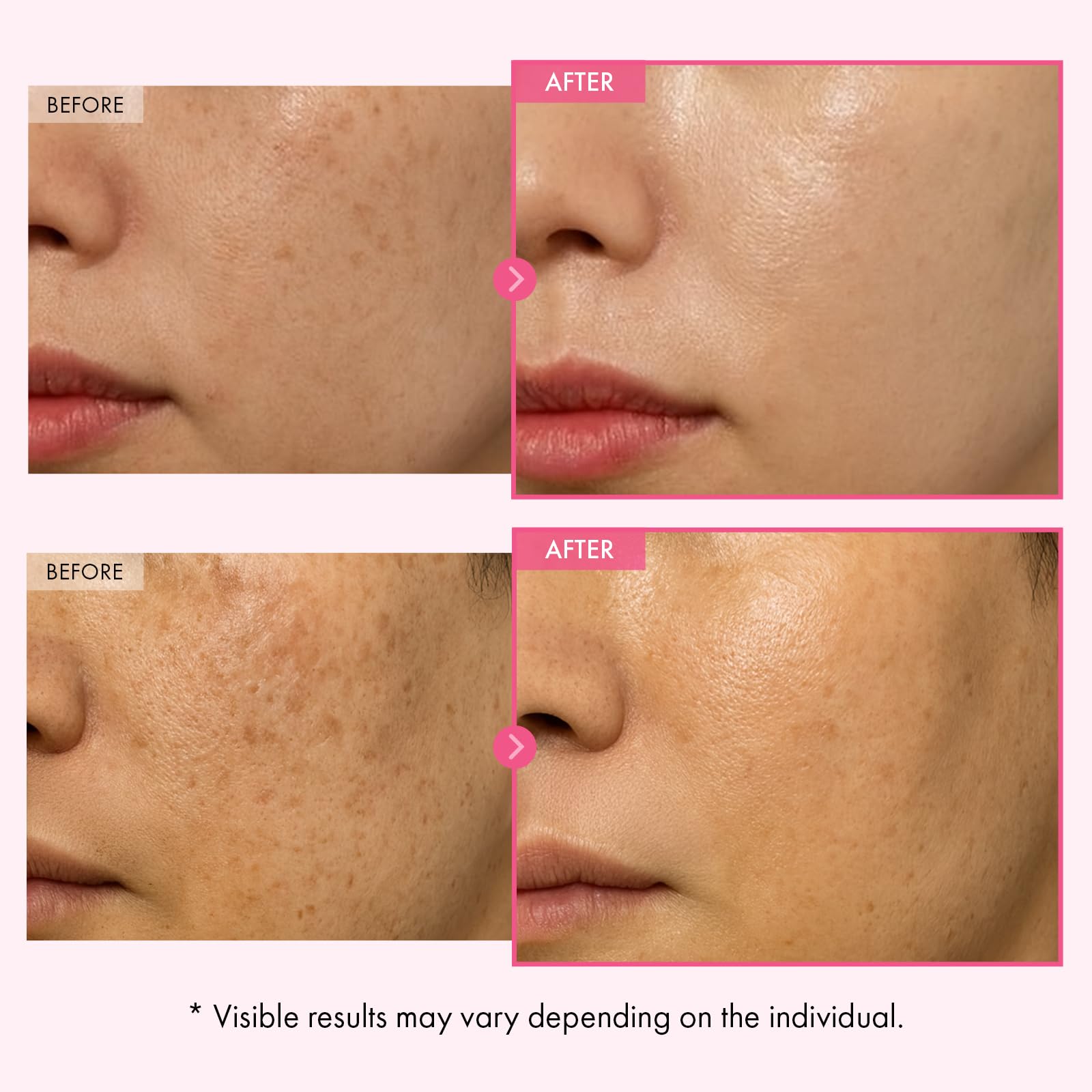 TOSOWOONG Arbutin 7% Crème: application visage facile.