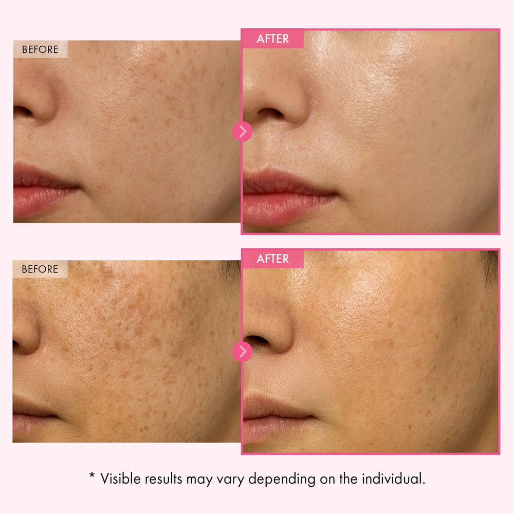 TOSOWOONG Arbutin 7% Crème: application visage facile.