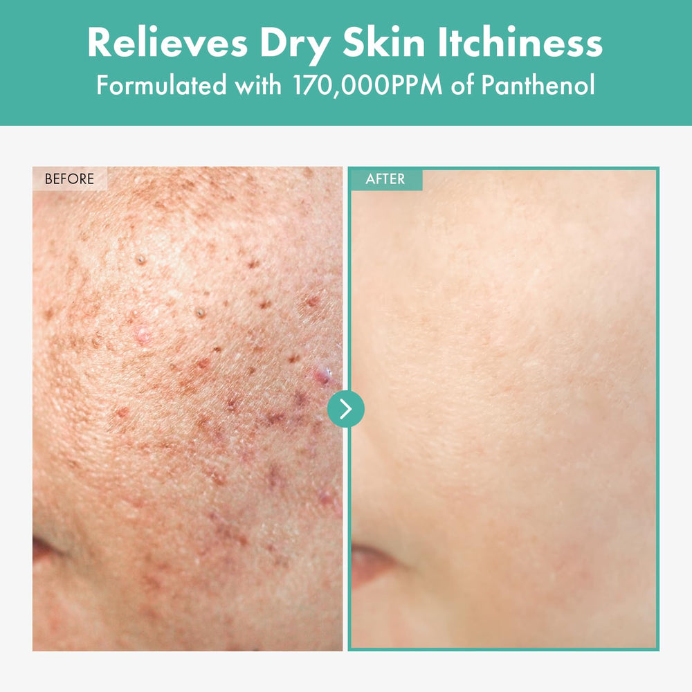 TOSOWOONG Dexpanthenol crema, textura suave y ligera para la piel.