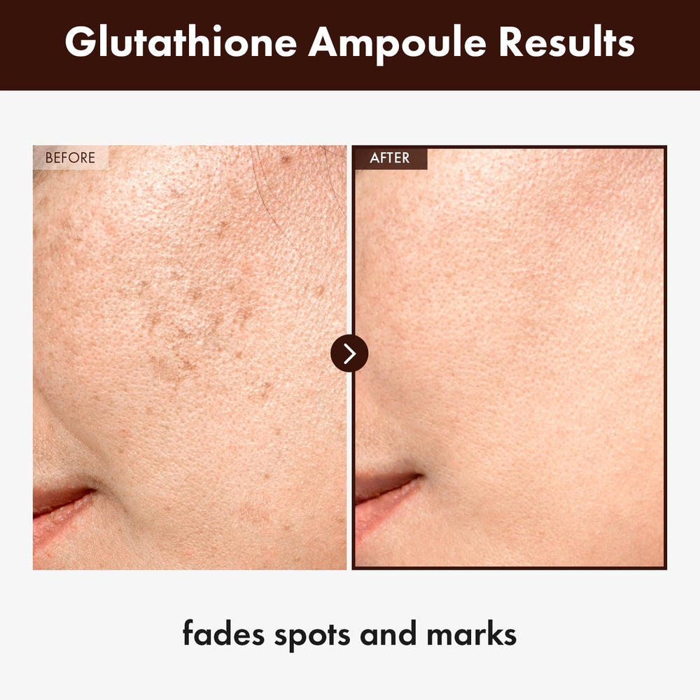 Dosis dispensadora del serum de glutacion de TOSOWOONG para aplicación precisa.