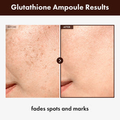Dosis dispensadora del serum de glutacion de TOSOWOONG para aplicación precisa.