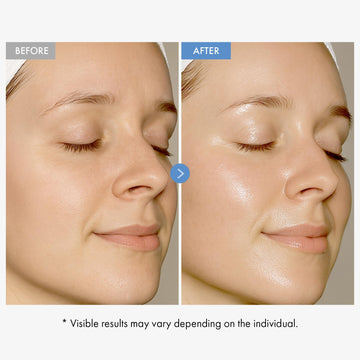 Aplicación diaria de TOSOWOONG Hyaluronic Acid 9 Cream sobre el rostro.