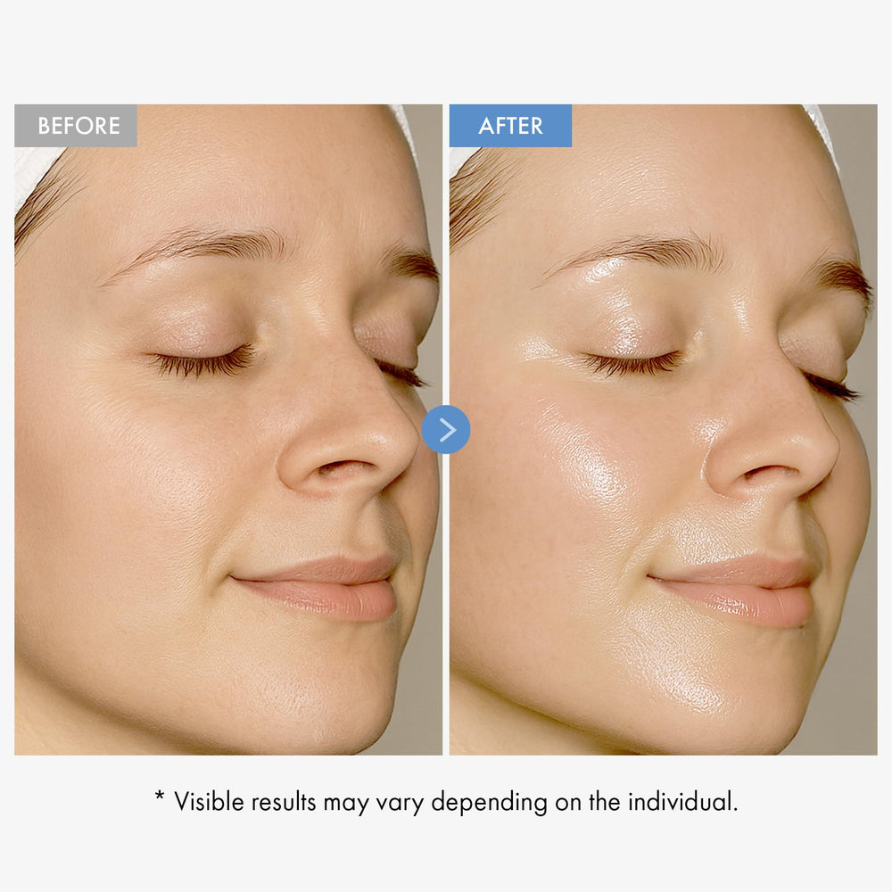 Aplicación diaria de TOSOWOONG Hyaluronic Acid 9 Cream sobre el rostro.
