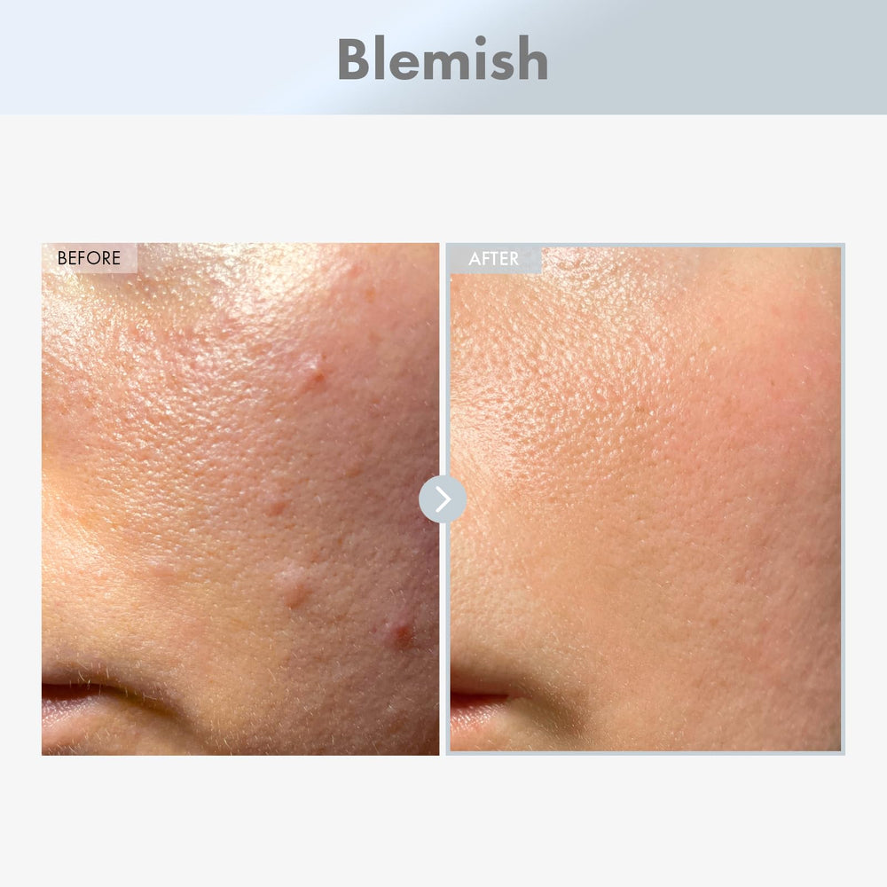 TOSOWOONG Niacinamide 15% serum, aplicación de dos gotas, reduce brillo y poros visibles.