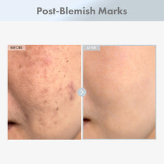 TOSOWOONG Niacinamide 15% serum, textura suave, piel más uniforme.