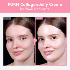 Aplicación diaria de TOSOWOONG PDRN crema gel de colágeno para suavidad y brillo.