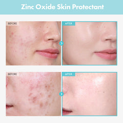 Aplicacion suave Tosowoong Reparacion CICA Clinica para piel sensible y cómoda
