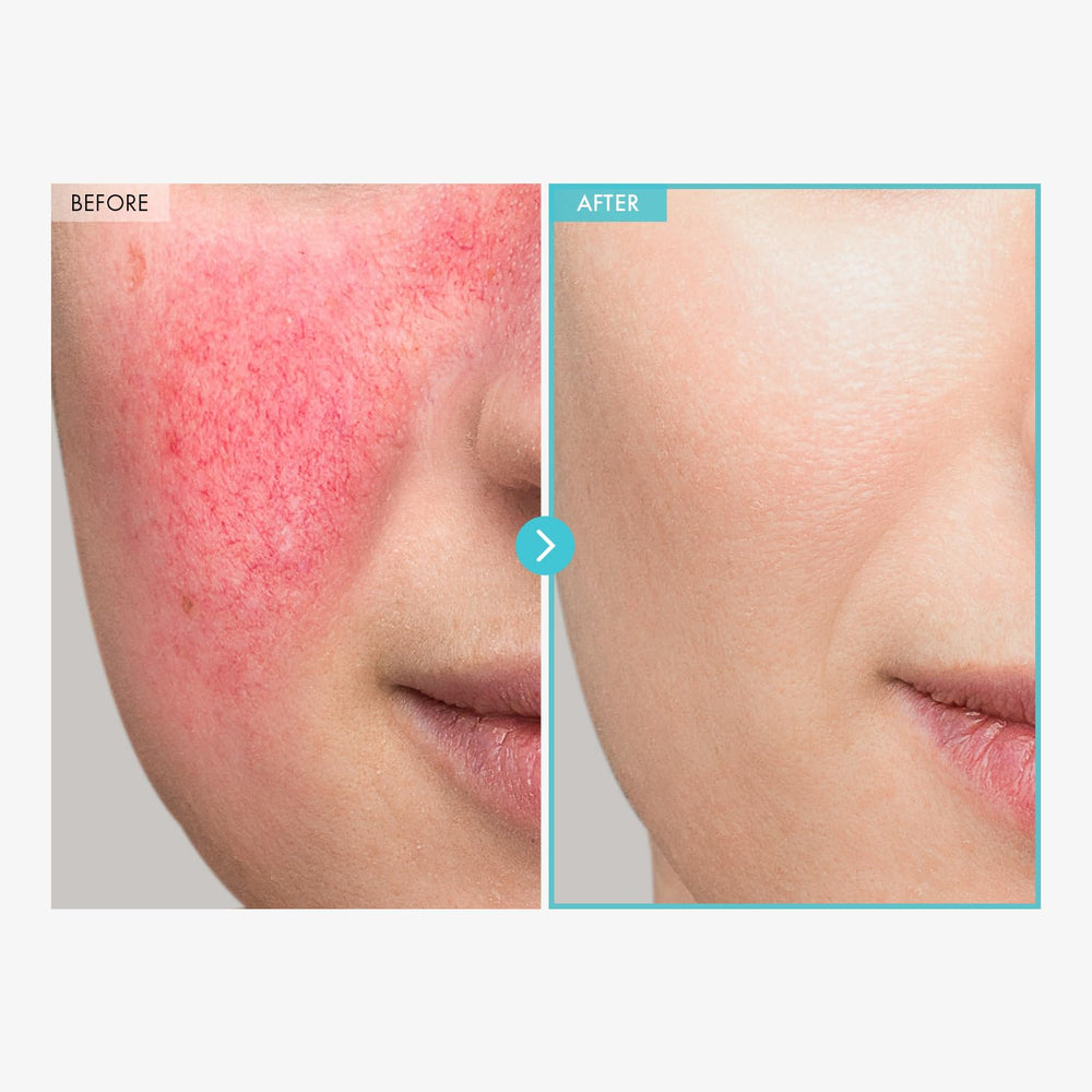 Textura cremosa Tosowoong Reparacion CICA Clinica, ideal para piel delicada y calmante
