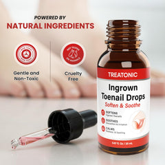 Caps de gel de silicona Treatonic para dedos del pie protegen la piel y reducen irritación.