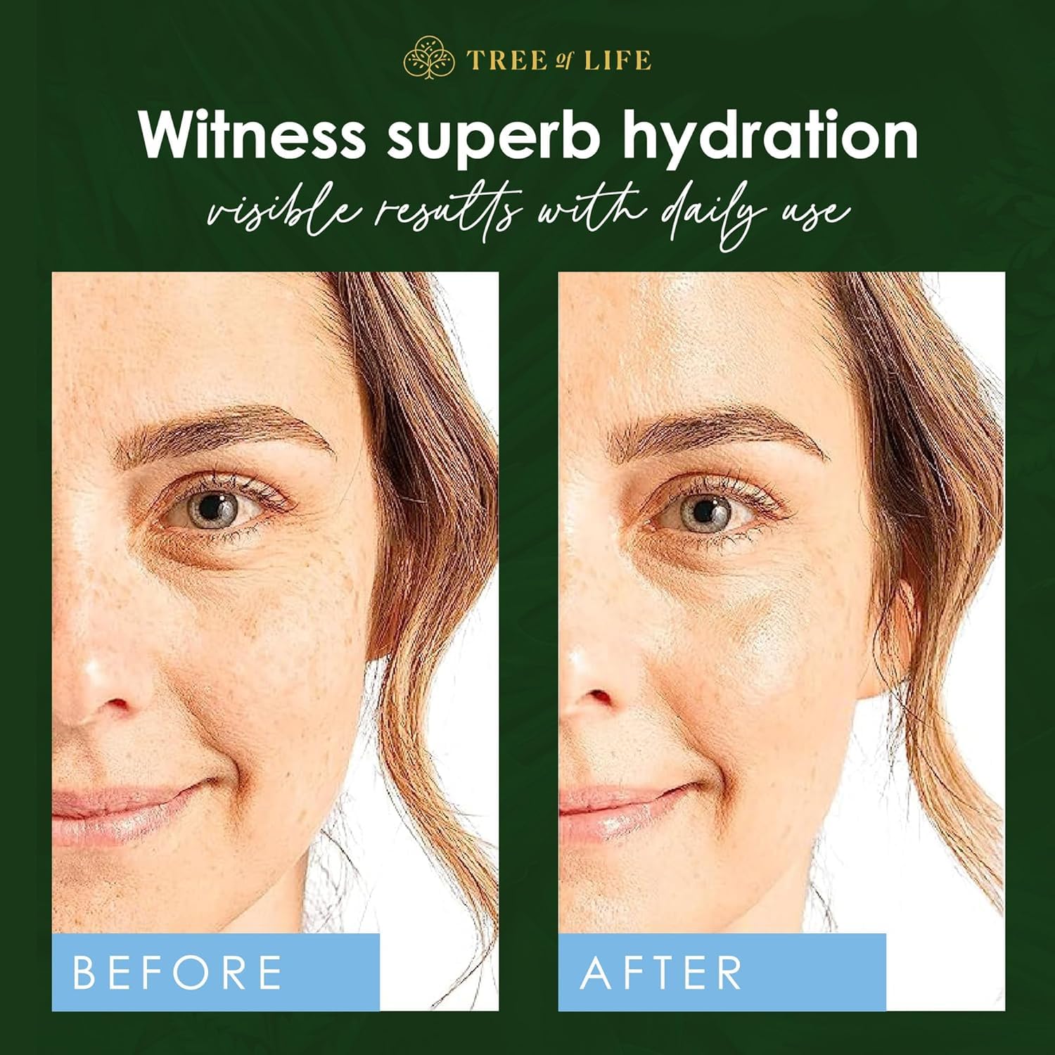 Cuidado para piel sensible con Tree of Life Serum hidratante.