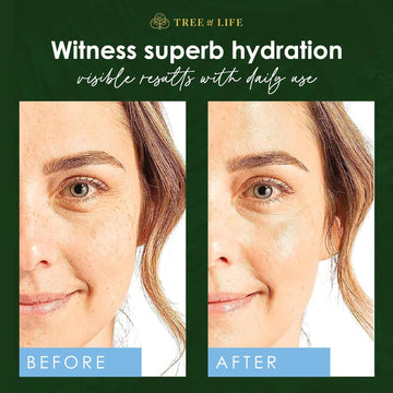 Cuidado para piel sensible con Tree of Life Serum hidratante.