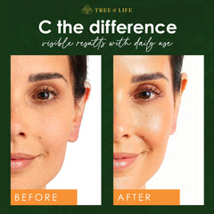 Tree of Life Serums Vitamina C - hidratación y luminosidad para piel sensible.