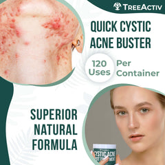 TreeActiv arcilla Bentonita Azufre Arbol de Te: ingredientes naturales