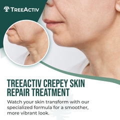 Crème TreeActiv texture lisse — peau nourrie après chaque massage.