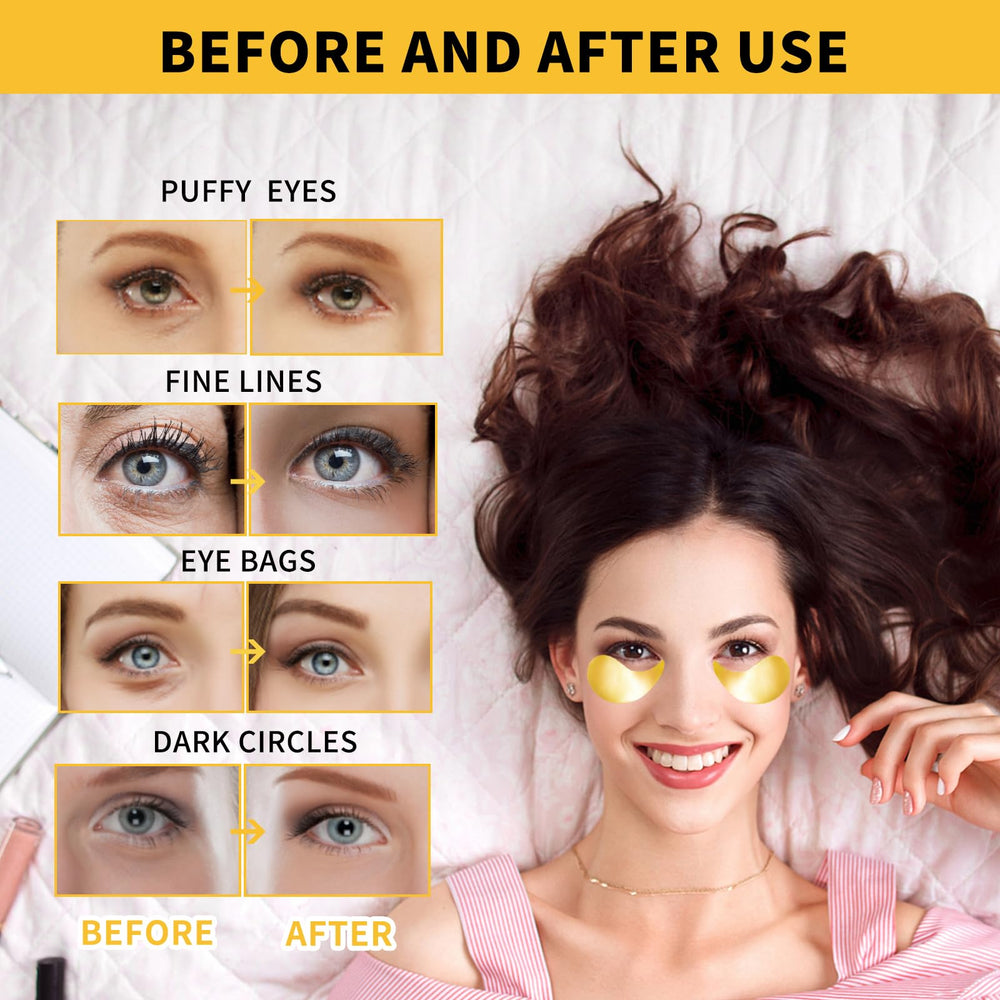 Treondexir travel packaging image emphasizes on-the-go skincare convenience.