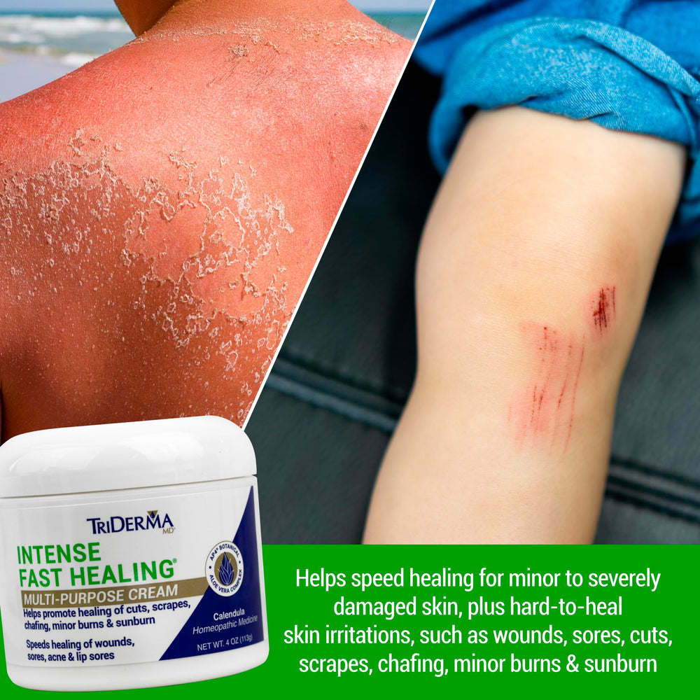 Aplicación de TriDerma en manos para irritaciones y sequedad.