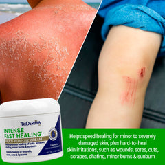 Aplicación de TriDerma en manos para irritaciones y sequedad.
