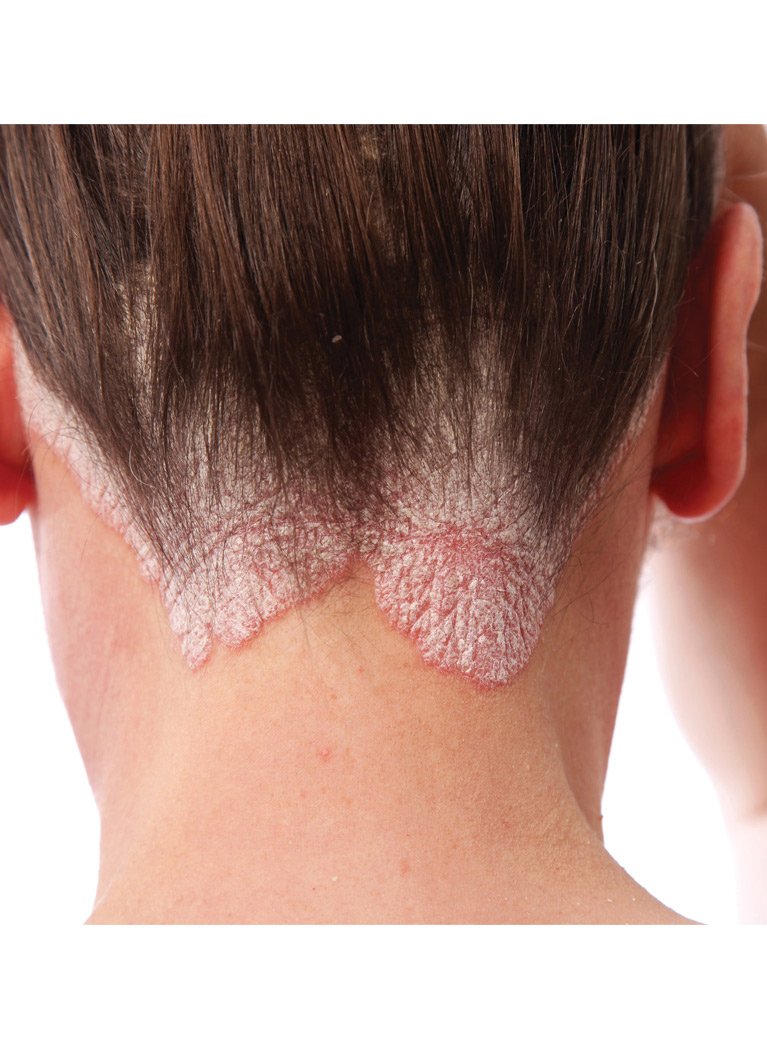 TriDerma champú romero, aroma fresco y cabello suave tras cada lavado.