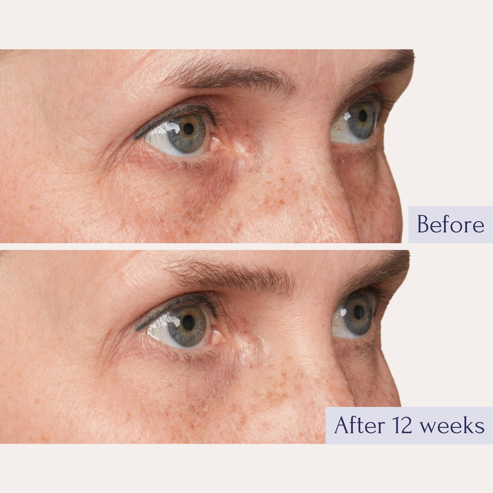 Tru Alchemy Eye Elixir ácido hialurónico hidrata contorno de ojos