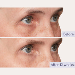 Tru Alchemy Eye Elixir ácido hialurónico hidrata contorno de ojos