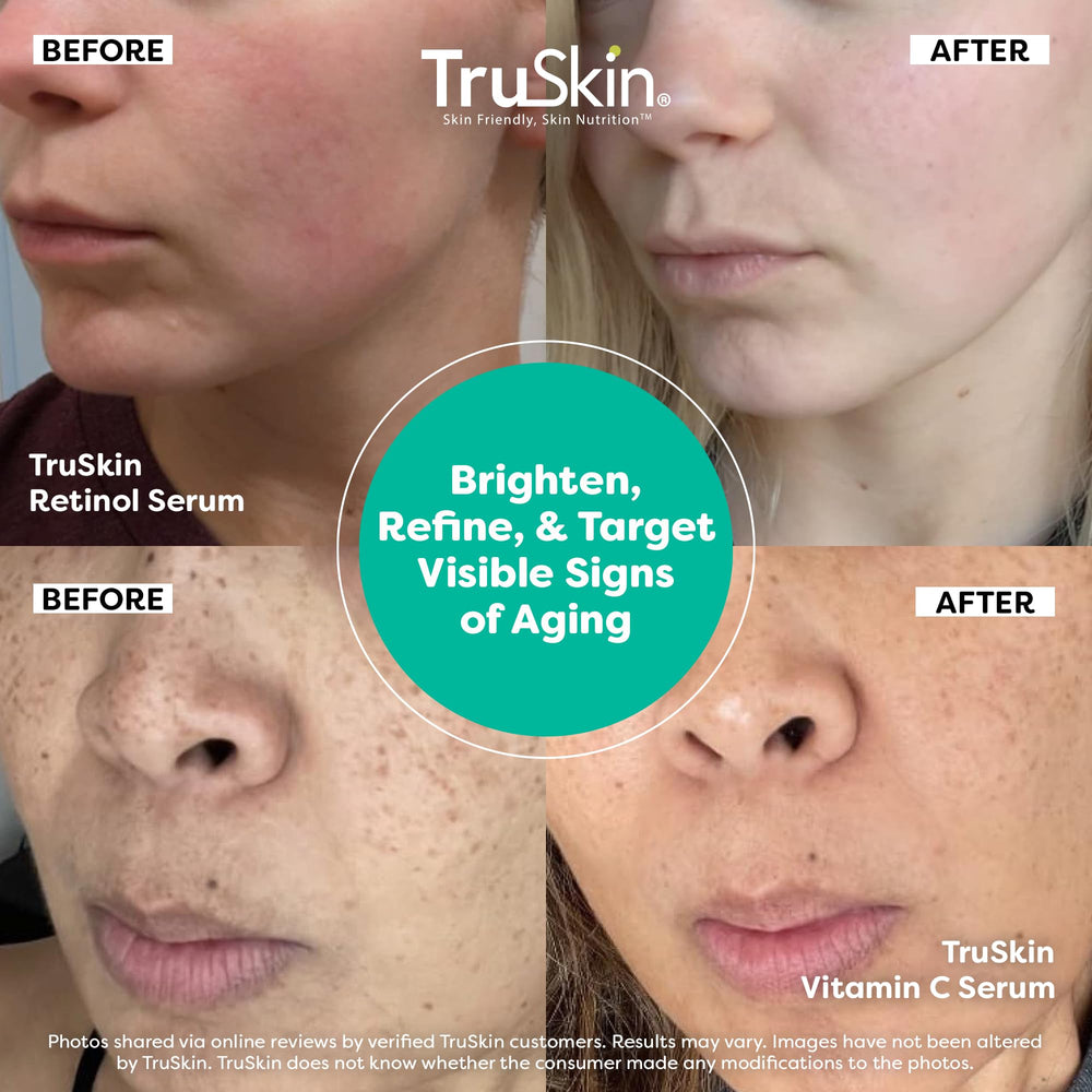 Suero TruSkin retinol de noche para renovación suave