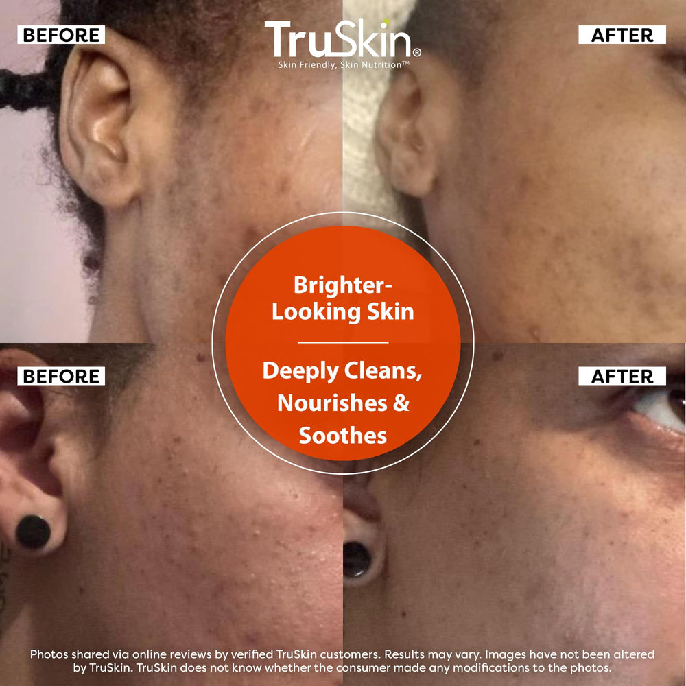 TruSkin Vitamina C aloe vera limpiador suave para piel calmada