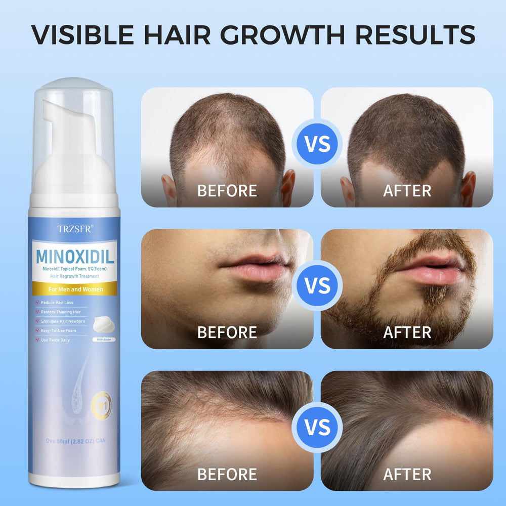 Trzsfr crecimiento barba, uso diario para barba más densa
