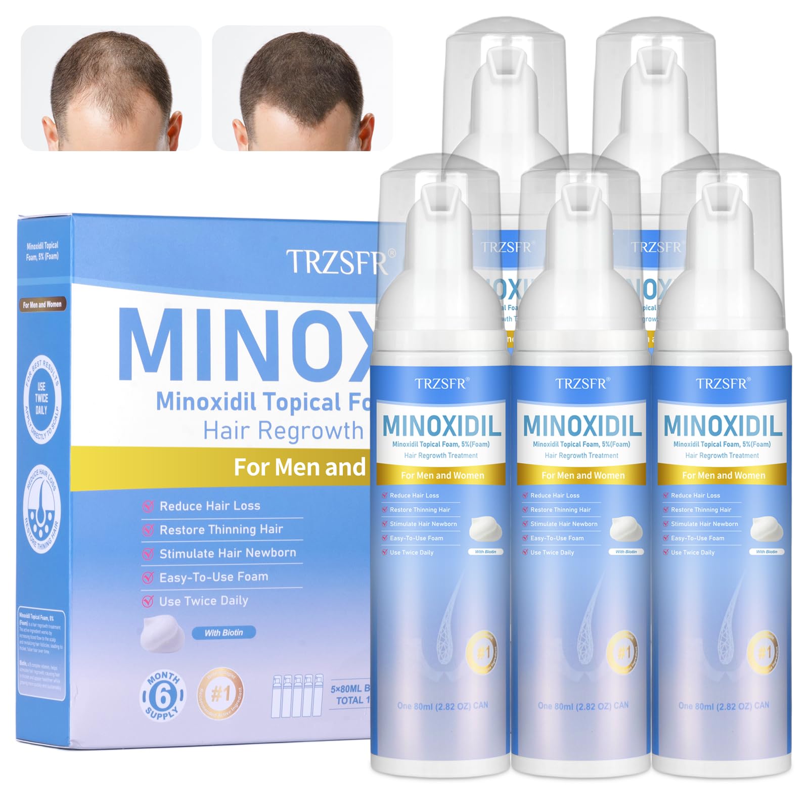 Trzsfr Minoxidil 5% espuma para cabello, uso diario para mayor densidad