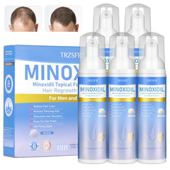 Trzsfr Minoxidil 5% espuma para cabello, uso diario para mayor densidad