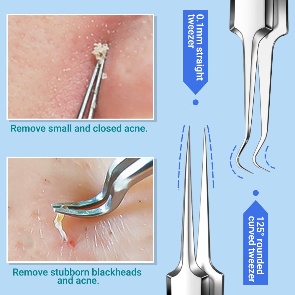 TsMADDTs extractor comedones, herramienta precisa para limpiar poros sin dolor.