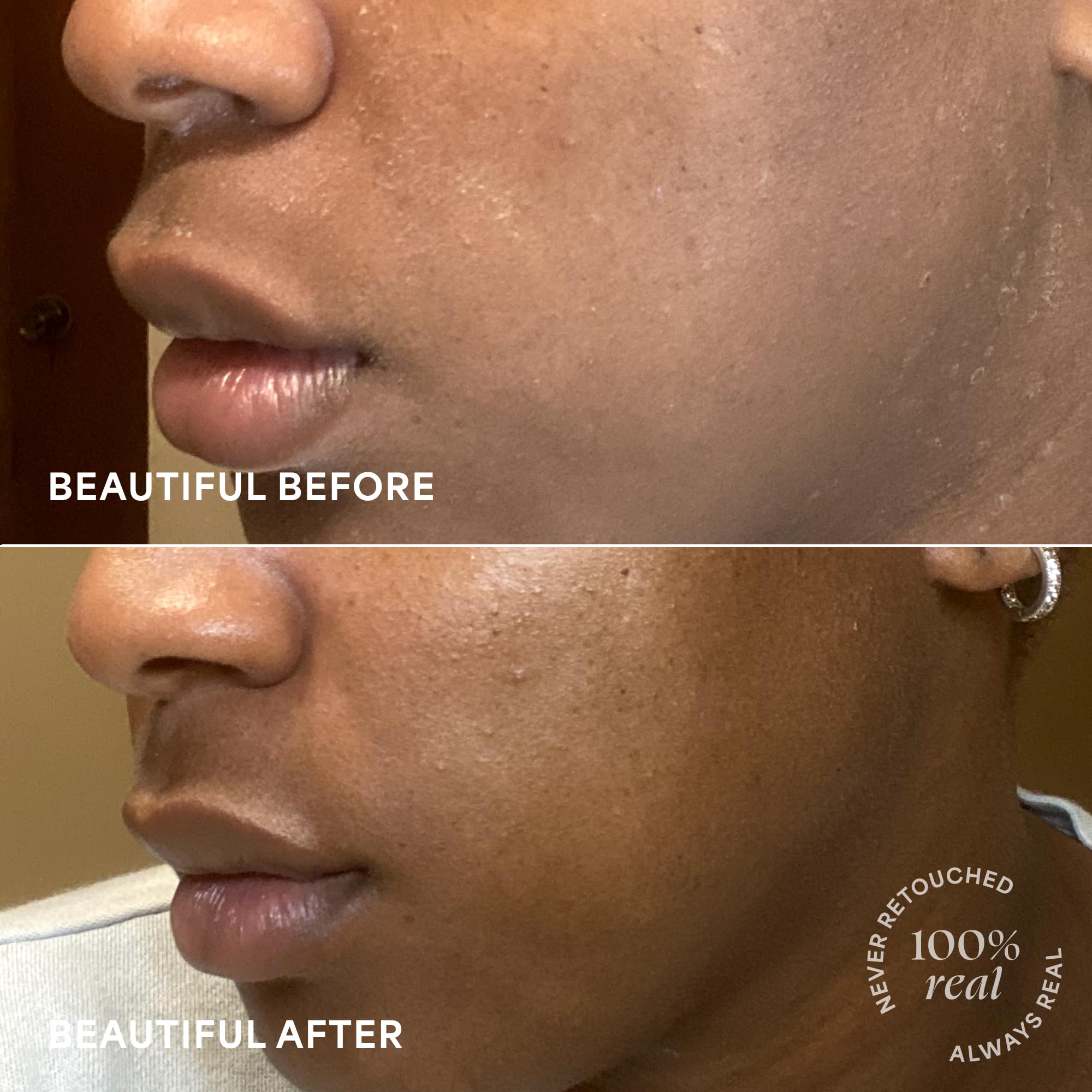 Dosis fácil para aplicación precisa en rostro.