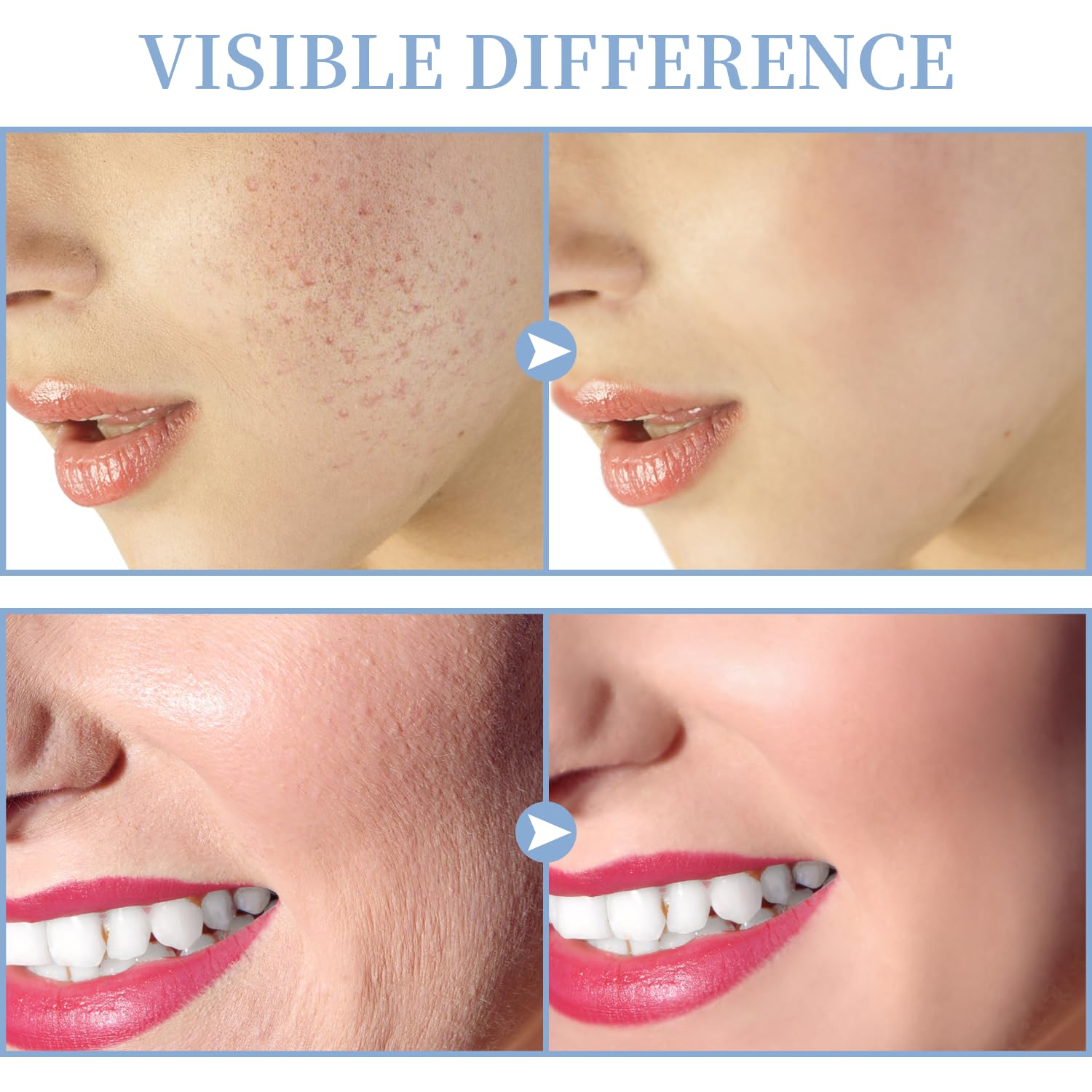 TUMAKOU uso directo e indirecto para adaptar la sesión