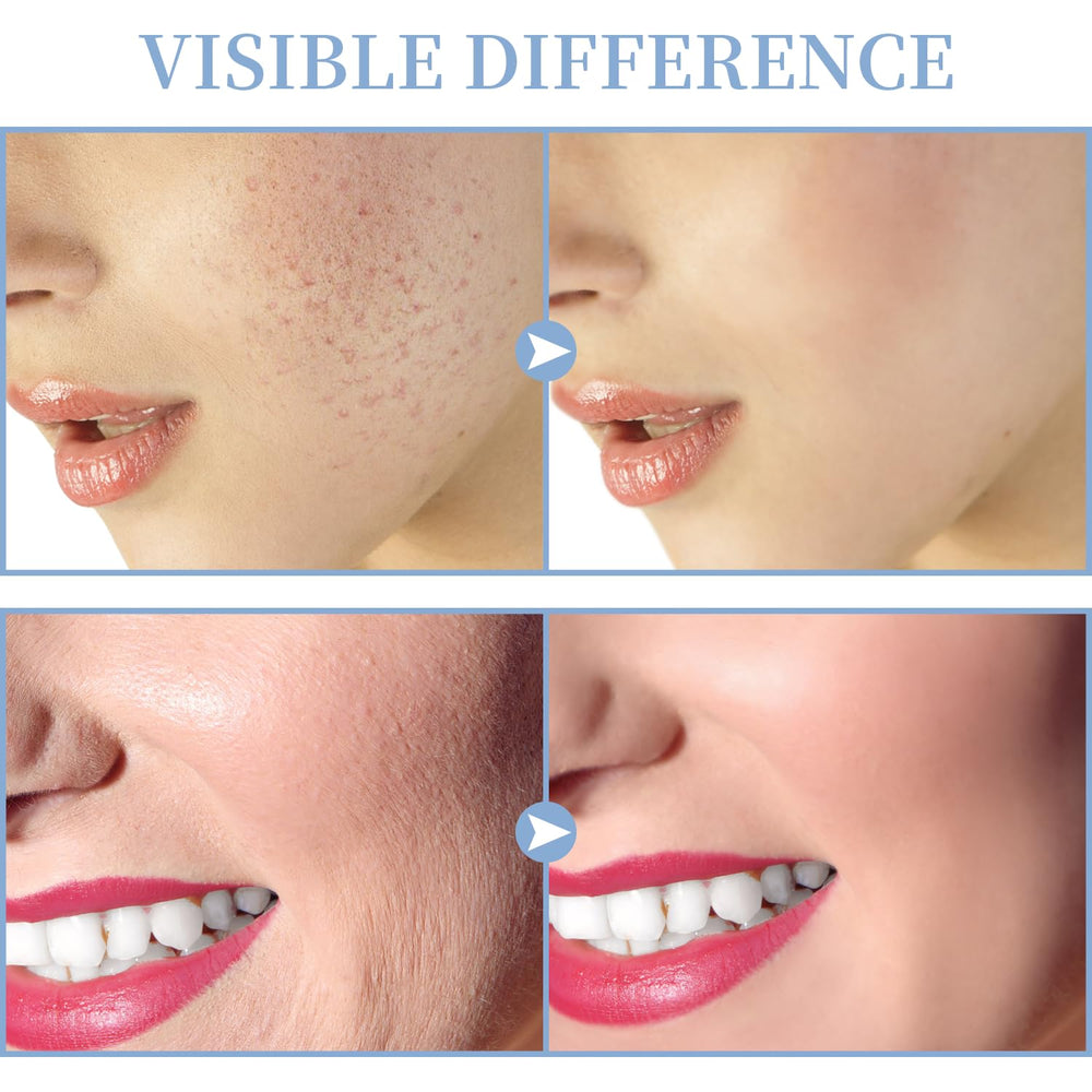 TUMAKOU uso directo e indirecto para adaptar la sesión