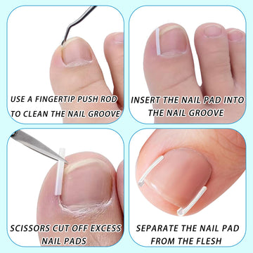 Tyalfrich set cuidado uñas completo: solución en casa para el cuidado de uñas.