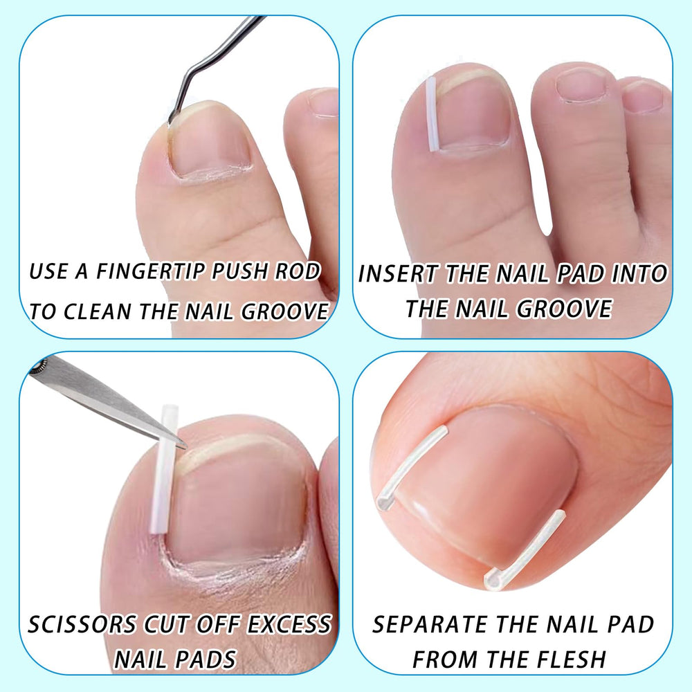 Tyalfrich set cuidado uñas completo: solución en casa para el cuidado de uñas.