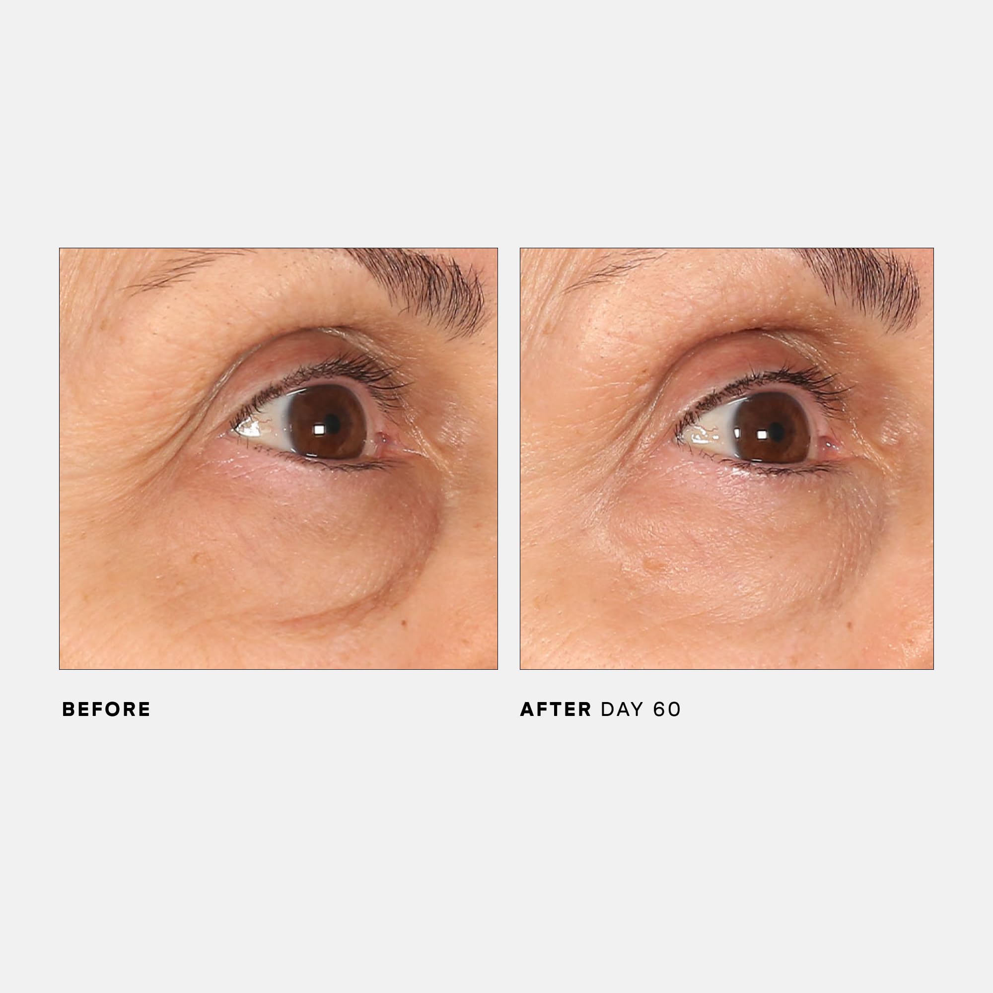U Beauty The RETURN Eye Concentrate, envase práctico para uso diario