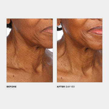 U Beauty SCULPT: efecto firmeza en cuello y contorno con uso diario.