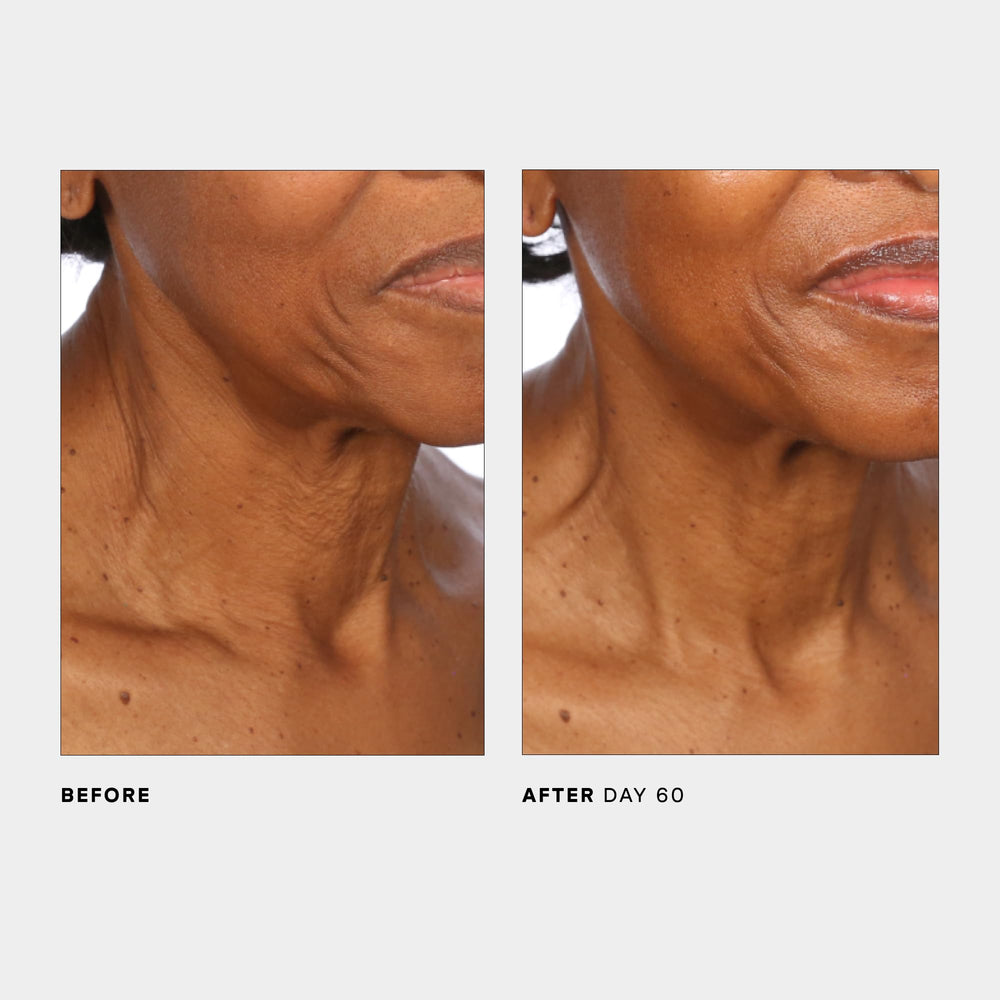 U Beauty SCULPT: efecto firmeza en cuello y contorno con uso diario.