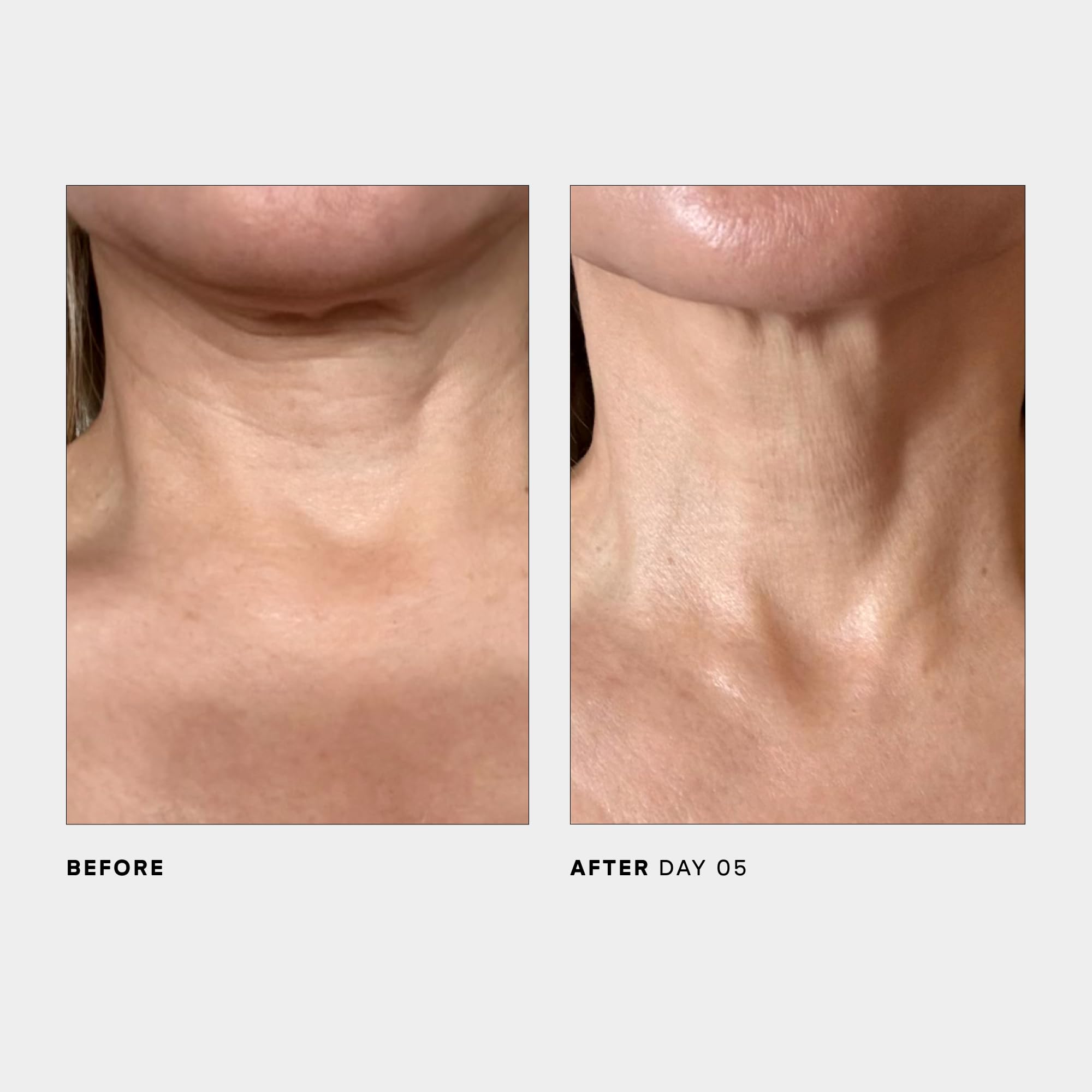 U Beauty SCULPT: vitaminas C y E estabilizadas para luminosidad suave.